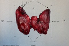 Gross orientation of the thyroid gland