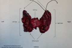 Gross orientation of the thyroid gland