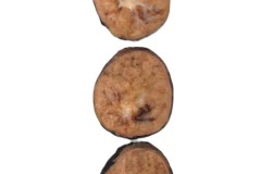 Non-invasive follicular thyroid neoplasm with papillary-like nuclear features (NIFTP)