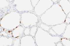 C cells in the thyroid gland: Immunohistochemistry for calcitonin.
