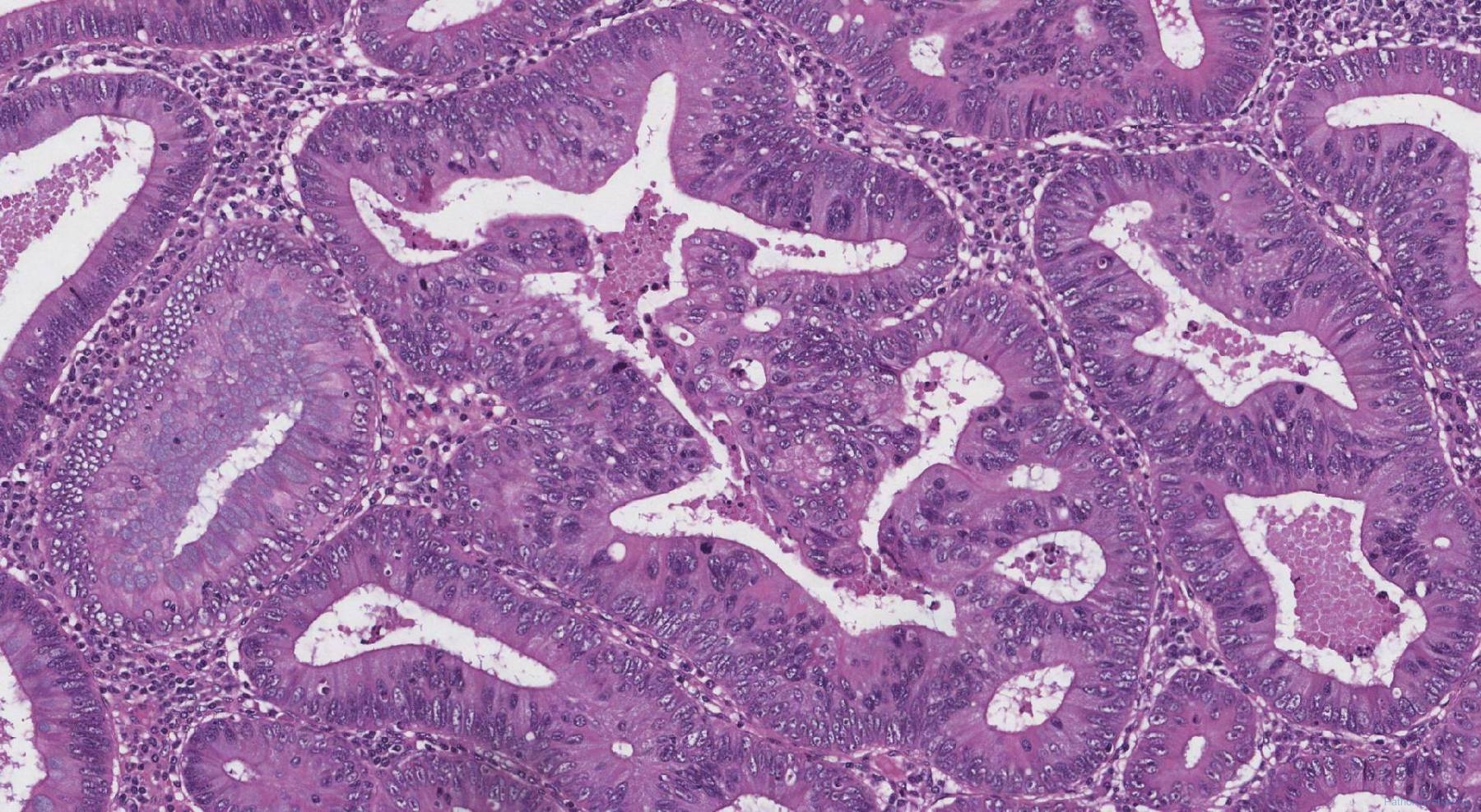 Tva archives atlas of pathology